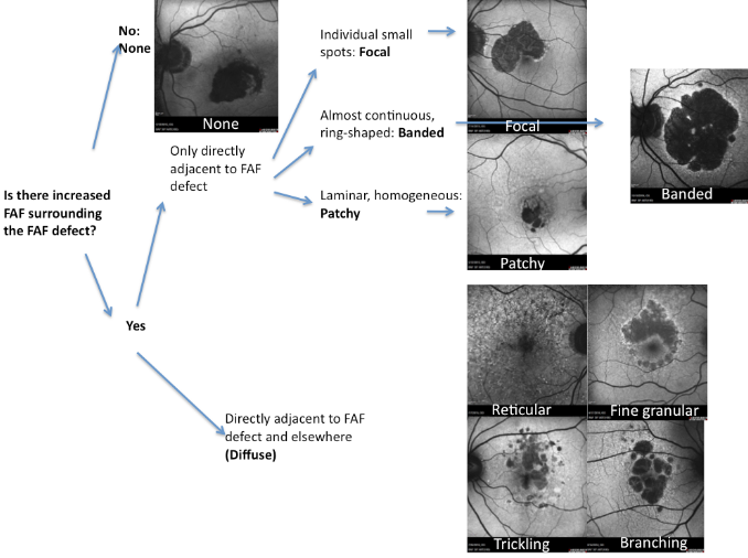 fundus autofluopresence_image19.png