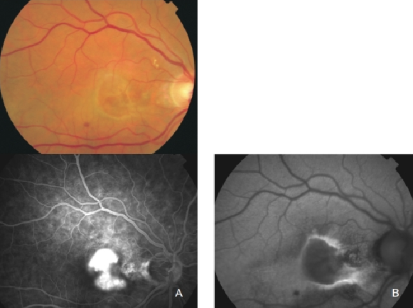 fundus autofluopresence_image26_0.png