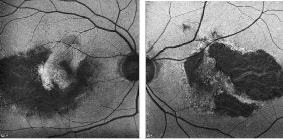 fundus autofluopresence_image31.png