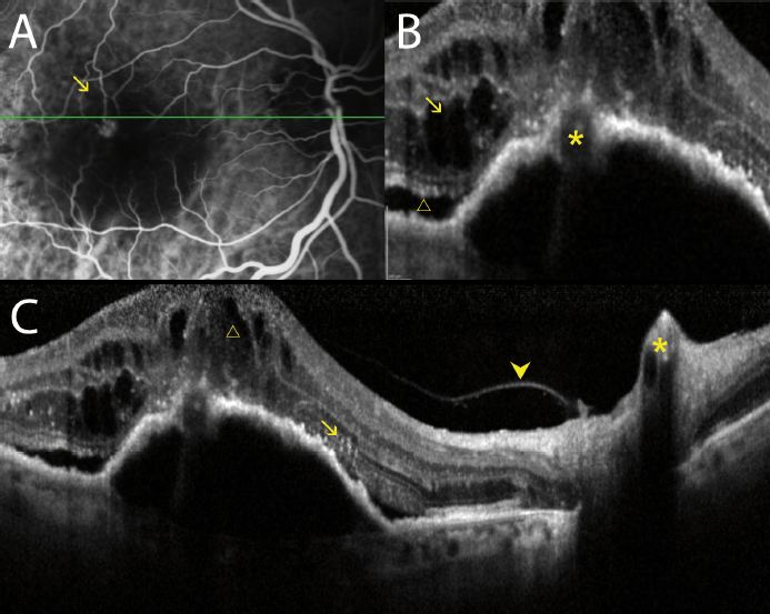 Figure 11